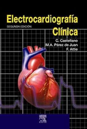 Electrocardiografía clínica